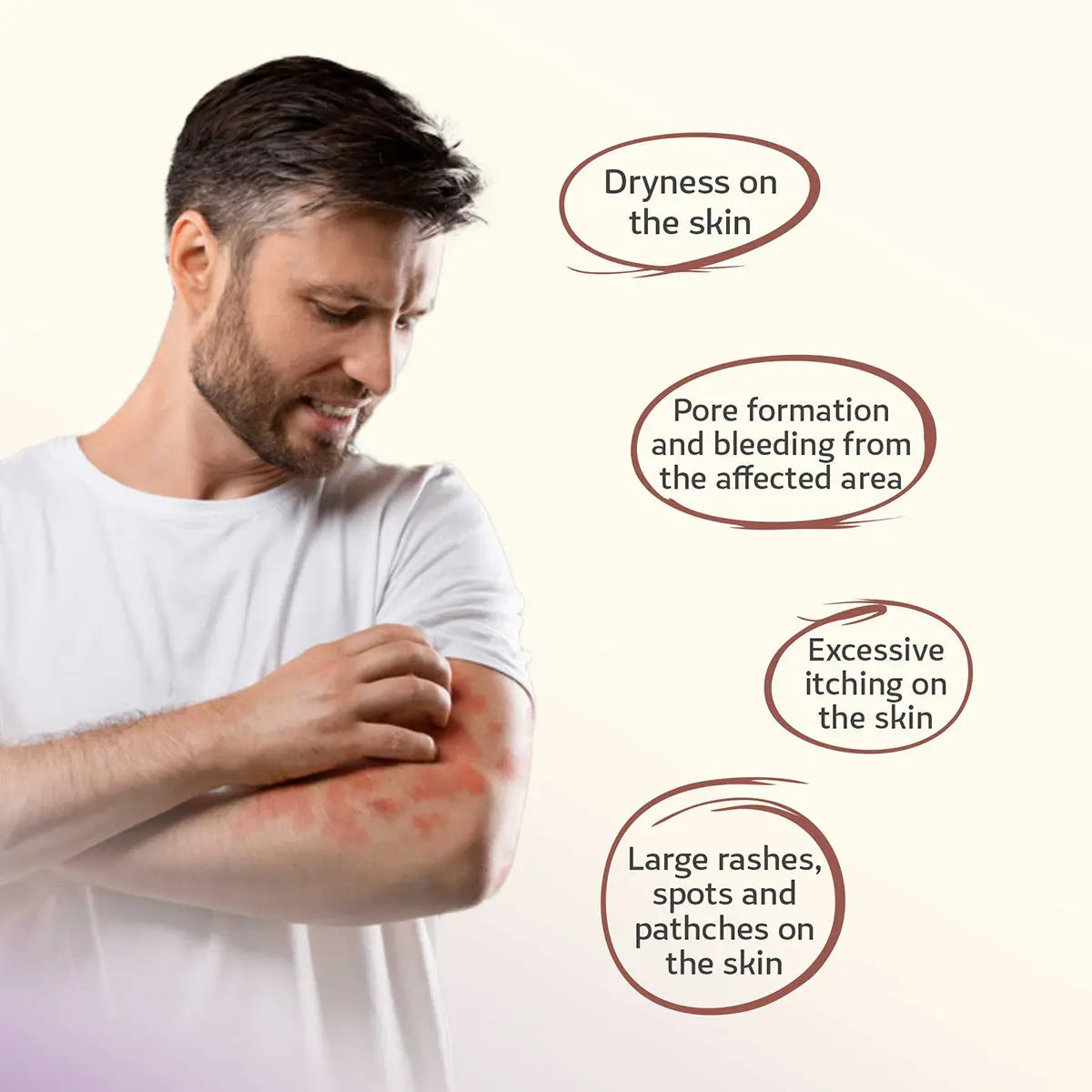 Resolve Issues By Swaarnim Psoriasis Care Capsule