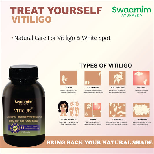 SWAARNIM LEUCODERMA CARE VITICURE+ CAPSULE